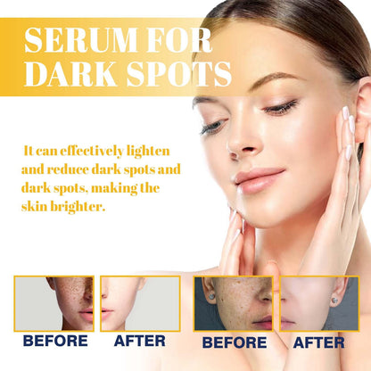 Dark Spot Serum